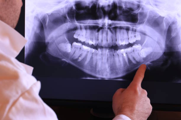 Best Emergency Tooth Extraction in Palmyra, IN