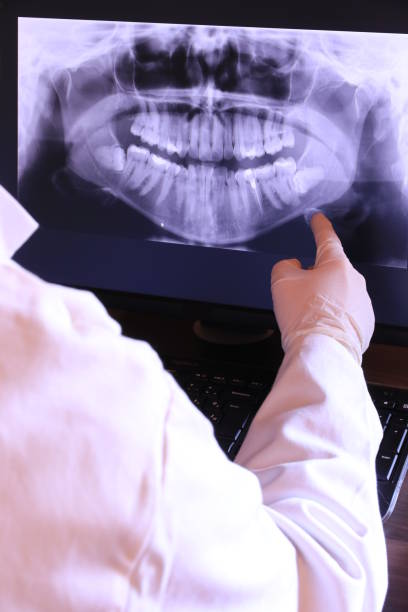 Best Emergency Wisdom Teeth Removal in Palmyra, IN