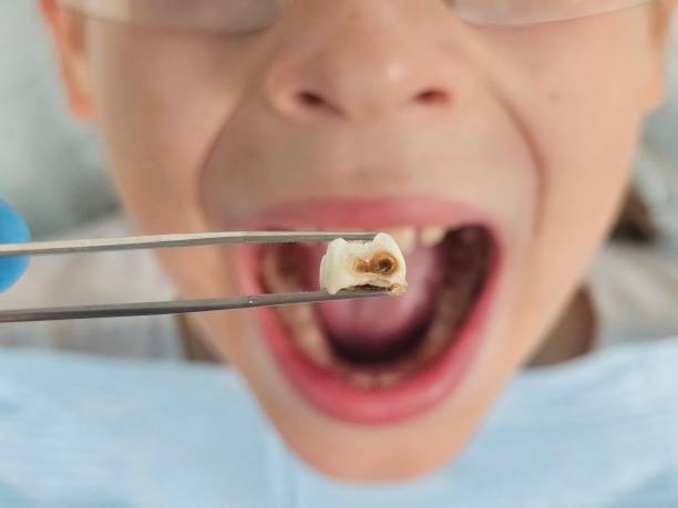 Best Weekend Emergency Dentist in Palmyra, IN